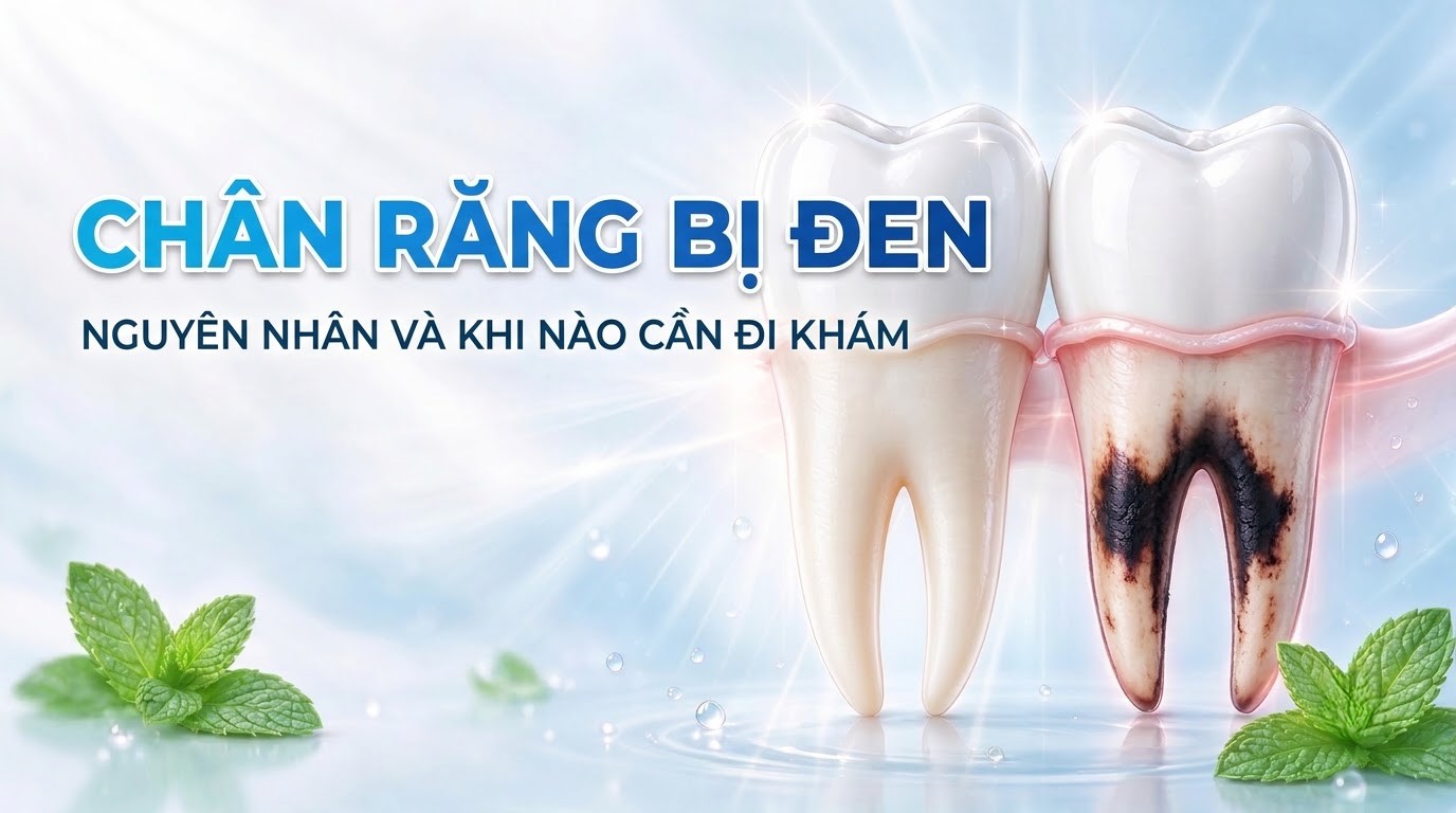 Chân Răng Bị Đen: Nguyên Nhân Và Khi Nào Cần Đi Khám
