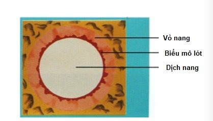 Triệu chứng và dấu hiệu nhận biết nang răng
